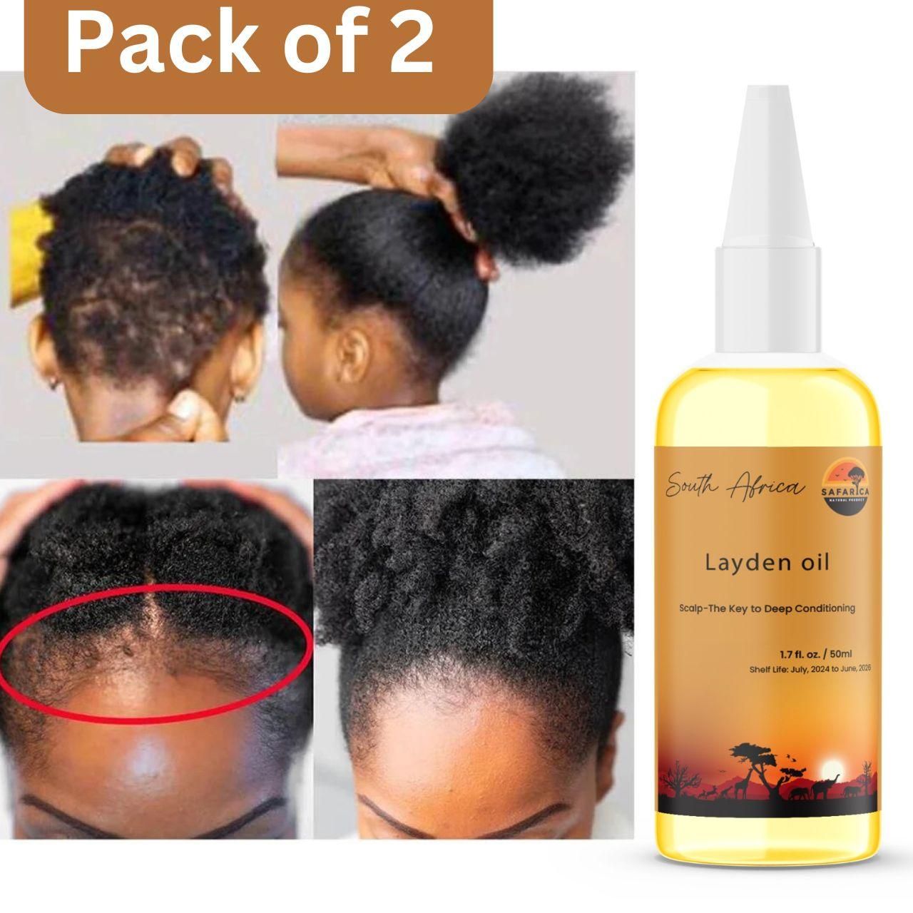 Layden Oil Scalp - The Key to Deep Conditioning 50ML (Pack of 2)